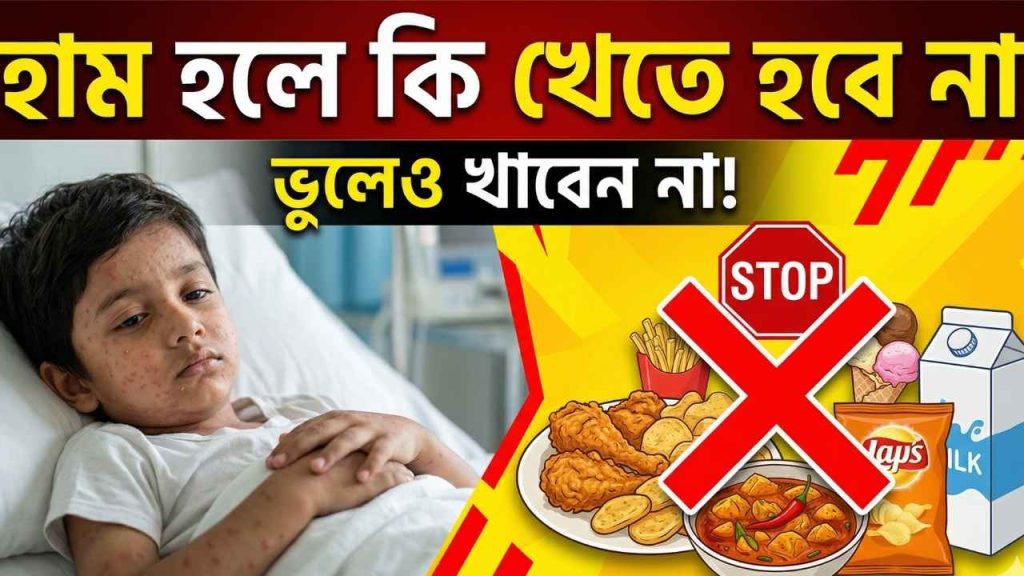 হাম হলে কি খেতে হবে না